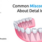 Misconception of Patients about Dental Implants