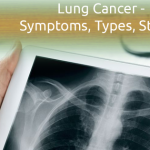 Lung Cancer – Symptoms, Types, Stages